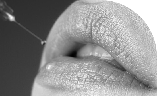 Frame-6574-1 Injectables & Fillers