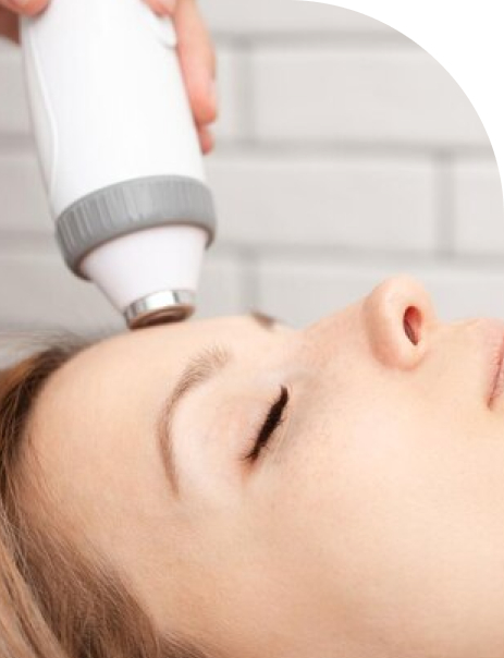 Frame-6574 RF Microneedling