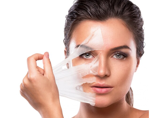 Frame-6584-1 Chemical Peels