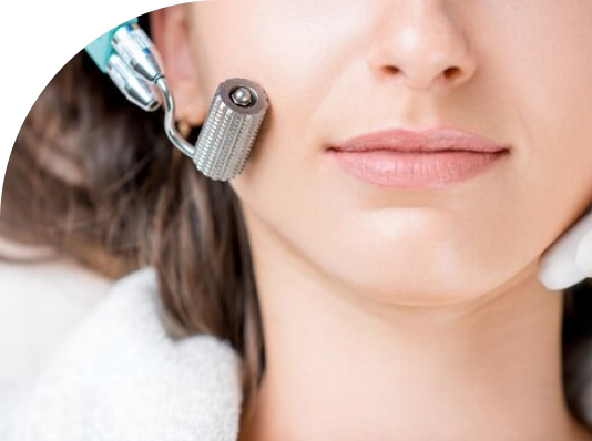 Frame-6585-2-1 Microneedling