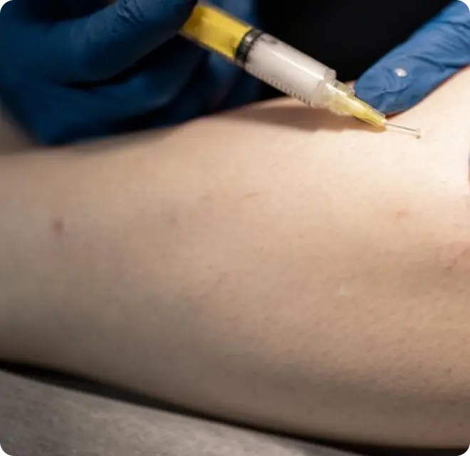 Kenalog Injections in Katy